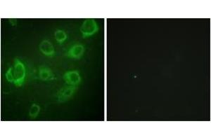 Immunofluorescence analysis of HuvEc cells, using Myosin regulatory light chain 2 (Phospho-Ser18) Antibody. (MYL9 抗体  (pSer18))