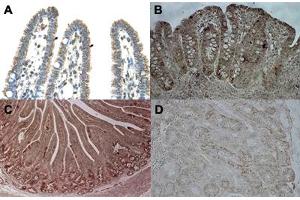 Immunohistochemical staining (Formalin-fixed paraffin-embedded sections) of human intestine (A), pig ileum (B), pig duodenum (C) and pig kidney (D) with CPS1 polyclonal antibody . (CPS1 抗体  (Internal Region))