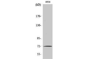 Western Blotting (WB) image for anti-Matrix Metalloproteinase 2 (MMP2) (C-Term) antibody (ABIN3176049) (MMP2 抗体  (C-Term))