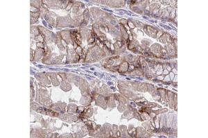 ABIN6277257 at 1/100 staining human kidney tissues  sections by IHC-P. (IL-8 抗体  (Internal Region))