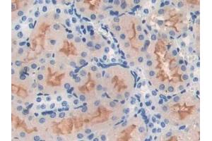 Detection of NOS1 in Mouse Kidney Tissue using Polyclonal Antibody to Nitric Oxide Synthase 1, Neuronal (NOS1) (NOS1 抗体  (AA 53-247))