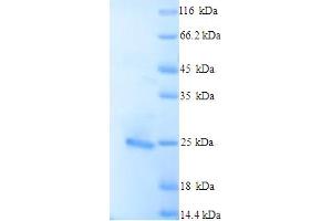 SDS-PAGE (SDS) image for BCL2-Like 11 (Apoptosis Facilitator) (BCL2L11) (AA 1-198), (full length) protein (His tag) (ABIN5713280) (BIM Protein (AA 1-198, full length) (His tag))