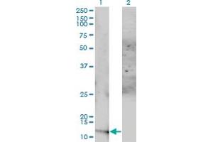 Western Blot analysis of ACYP1 expression in transfected 293T cell line by ACYP1 monoclonal antibody (M01), clone 1B2-3A2. (ACYP1 抗体  (AA 1-99))