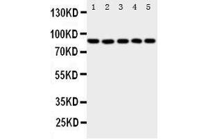 Western Blotting (WB) image for anti-Arachidonate 5-Lipoxygenase (ALOX5) (AA 650-667), (C-Term) antibody (ABIN3044238) (ALOX5 抗体  (C-Term))