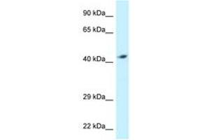 Image no. 1 for anti-ATPase, H+ Transporting, Lysosomal 42kDa, V1 Subunit C2 (ATP6V1C2) (AA 287-336) antibody (ABIN6747743)