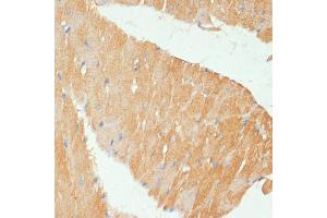 Immunohistochemistry of paraffin-embedded mouse heart using MYBPC3 antibody (ABIN6129601, ABIN6144221, ABIN6144222 and ABIN6215951) at dilution of 1:100 (40x lens). (MYBPC3 抗体  (AA 200-400))