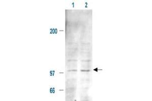 Immunoblotting of Mdm2 (phospho S185) polyclonal antibody  is shown to detect a 102 kDa band (arrow) corresponding to phosphorylated mouse Mdm2 present in a 293T whole cell lysate.