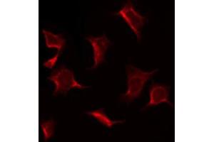 ABIN6269092 staining K562 by IF/ICC. (EIF2S1 抗体  (N-Term))