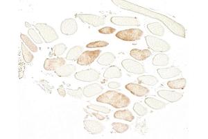 Immunohistochemistry (IHC) image for anti-Troponin I (TNNI) antibody (ABIN7795609)