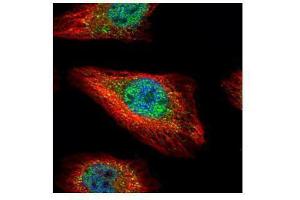 ICC/IF Image Confocal immunofluorescence analysis (Olympus FV10i) of paraformaldehyde-fixed HeLa, using SMAD5, antibody (Green) at 1:500 dilution. (SMAD5 抗体)