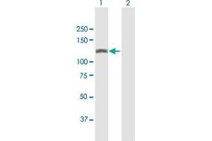Western Blotting (WB) image for anti-SWI/SNF Related, Matrix Associated, Actin Dependent Regulator of Chromatin, Subfamily A, Member 5 (SMARCA5) (AA 1-1052) antibody (ABIN521924)