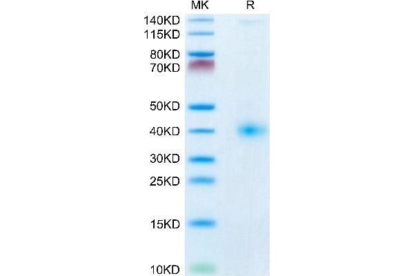CD161 Protein (AA 67-225) (His tag)