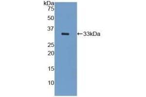 Detection of Recombinant KRT5, Mouse using Polyclonal Antibody to Cytokeratin 5 (CK5) (Cytokeratin 5 抗体  (AA 163-471))
