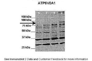Western Blotting (WB) image for anti-ATPase, H+ Transporting, Lysosomal V0 Subunit A1 (ATP6V0A1) (C-Term) antibody (ABIN2780008)