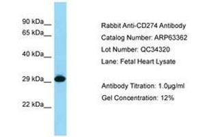 Image no. 1 for anti-CD274 (PD-L1) (C-Term) antibody (ABIN6749975) (PD-L1 抗体  (C-Term))
