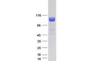 Western Blotting (WB) image for RAP1 GTPase Activating Protein 2 (RAP1GAP2) (Transcript Variant 1) protein (Myc-DYKDDDDK Tag) (ABIN2722355)