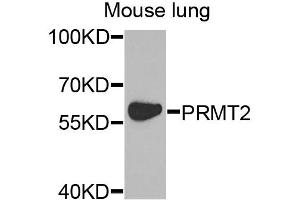 Western blot analysis of extracts of mouse lung, using PRMT2 antibody. (PRMT2 抗体)