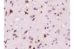 Paraformaldehyde-fixed, paraffin embedded rat brain, Antigen retrieval by boiling in sodium citrate buffer (pH6) for 15min, Block endogenous peroxidase by 3% hydrogen peroxide for 30 minutes, Blocking buffer (normal goat serum) at 37°C for 20min, Antibody incubation with LIMK1 Polyclonal Antibody (bs-2775R) at 1:400 overnight at 4°C, followed by a conjugated secondary and DAB staining. (LIM Domain Kinase 1 抗体  (AA 451-550))