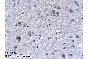 Formalin-fixed and paraffin embedded rat brain labeled with Anti-BCL2L10 Polyclonal Antibody, Unconjugated (ABIN714881) followed by conjugation to the secondary antibody and DAB staining (BCL2L10 抗体  (AA 101-194))