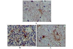 Immunohistochemical analysis of paraffin-embedded human brain tissue (A), lymphoid follicles tissue (B) and interbrain tissue (C), showing cytoplasmic localization using S100A antibody with DAB staining. (S100A1 抗体)