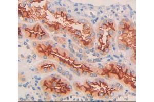 Immunohistochemistry (IHC) image for anti-Solute Carrier Family 12 (Potassium-Chloride Transporter) Member 6 (SLC12A6) (AA 559-735) antibody (ABIN1868807)
