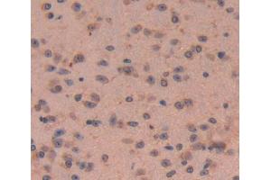 Used in DAB staining on fromalin fixed paraffin- embedded brain tissue (CKAP2 抗体)