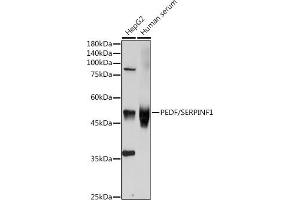 Western blot analysis of extracts of various cell lines, using SERPINF1 antibody (ABIN3022372, ABIN3022373, ABIN3022374, ABIN1513515 and ABIN6218766) at 1:1000 dilution. (PEDF 抗体  (AA 1-200))