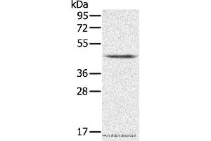 Western blot analysis of K562 cell, using PLTP Polyclonal Antibody at dilution of 1:200 (PLTP 抗体)