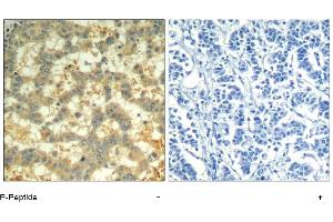 Image no. 1 for anti-Spleen tyrosine Kinase (SYK) (pTyr323) antibody (ABIN319291) (SYK 抗体  (pTyr323))