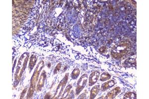 IHC analysis of RPS3 using anti-RPS3 antibody (ABIN6719371).