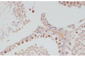 Immunohistochemistry of paraffin-embedded Rat testis using CCNG1 Polyclonal Antibody at dilution of 1:100 (40x lens). (Cyclin G1 抗体)