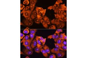 Immunofluorescence analysis of HeLa cells using RPS3 antibody (ABIN3023342, ABIN3023343, ABIN3023344 and ABIN6219623) at dilution of 1:100.