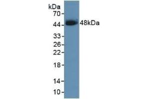 Detection of Recombinant SCCA1, Human using Polyclonal Antibody to Serpin B3 (SERPINB3) (SERPINB3 抗体  (AA 1-210))