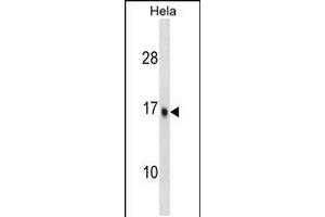 Western blot analysis in Hela cell line lysates (35ug/lane). (UBE2D3 抗体  (C-Term))