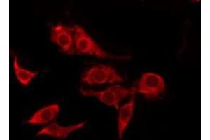 ABIN6277866 staining HepG2 by IF/ICC. (CD131 抗体  (C-Term))