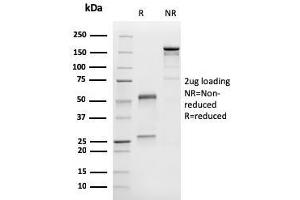 SDS-PAGE (SDS) image for anti-Melan A (MLANA) antibody (ABIN6939392)