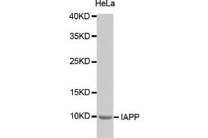 Western Blotting (WB) image for anti-Islet Amyloid Polypeptide (IAPP) antibody (ABIN1873117) (Amylin/DAP 抗体)