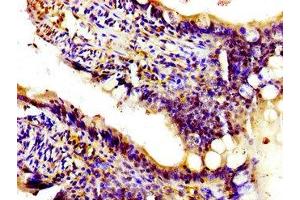 Immunohistochemistry of paraffin-embedded human small intestine tissue using ABIN7163188 at dilution of 1:100 (PIK3CA 抗体  (Catalytic Subunit alpha))