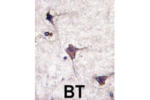 Formalin-fixed and paraffin-embedded human brain tissue reacted with PTPRR polyclonal antibody  , which was peroxidase-conjugated to the secondary antibody, followed by DAB staining. (PTPRR 抗体  (N-Term))