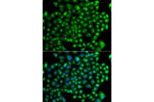 Immunofluorescence analysis of A549 cell using ZFYVE1 antibody. (ZFYVE1 抗体)