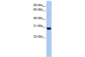 Western Blotting (WB) image for anti-Ankyrin Repeat and SOCS Box-Containing 12 (ASB12) antibody (ABIN2459538) (ASB12 抗体)
