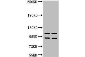 Western blot analysis of 1) Hela, 2) HepG2, diluted at 1:2000 (IDE 抗体)