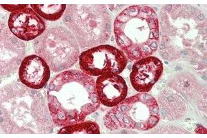 Detection of NOX4 in Human Kidney Tissue using Polyclonal Antibody to NADPH Oxidase 4 (NOX4) (NADPH Oxidase 4 抗体  (AA 220-392))