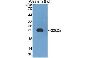 Western blot analysis of the recombinant protein. (UMPS 抗体  (AA 311-481))