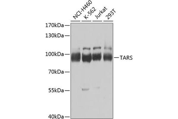 TARS 抗体  (AA 1-230)