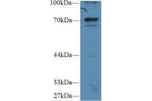 Western Blot; Sample: Human Hela cell lysate; Primary Ab: 1µg/ml Rabbit Anti-Human IkBz Antibody Second Ab: 0. (Inhibitory Subunit of NF-KappaB zeta (AA 422-651) 抗体)