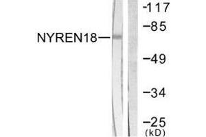 Western blot analysis of extracts from COS7 cells, using NYREN18 antibody. (NUB1 抗体  (C-Term))