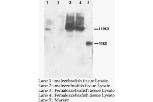 Western blot: PNPLA6 Polyclonal Antibody (PNPLA6 抗体  (C-Term))