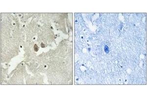 Immunohistochemistry analysis of paraffin-embedded human brain tissue, using NSG2 Antibody. (NSG2 抗体  (AA 33-82))
