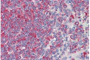 Human Spleen (formalin-fixed, paraffin-embedded) stained with CD34 antibody ABIN337152 at 10 ug/ml followed by biotinylated secondary antibody, alkaline phosphatase-streptavidin and chromogen. (CD34 抗体)